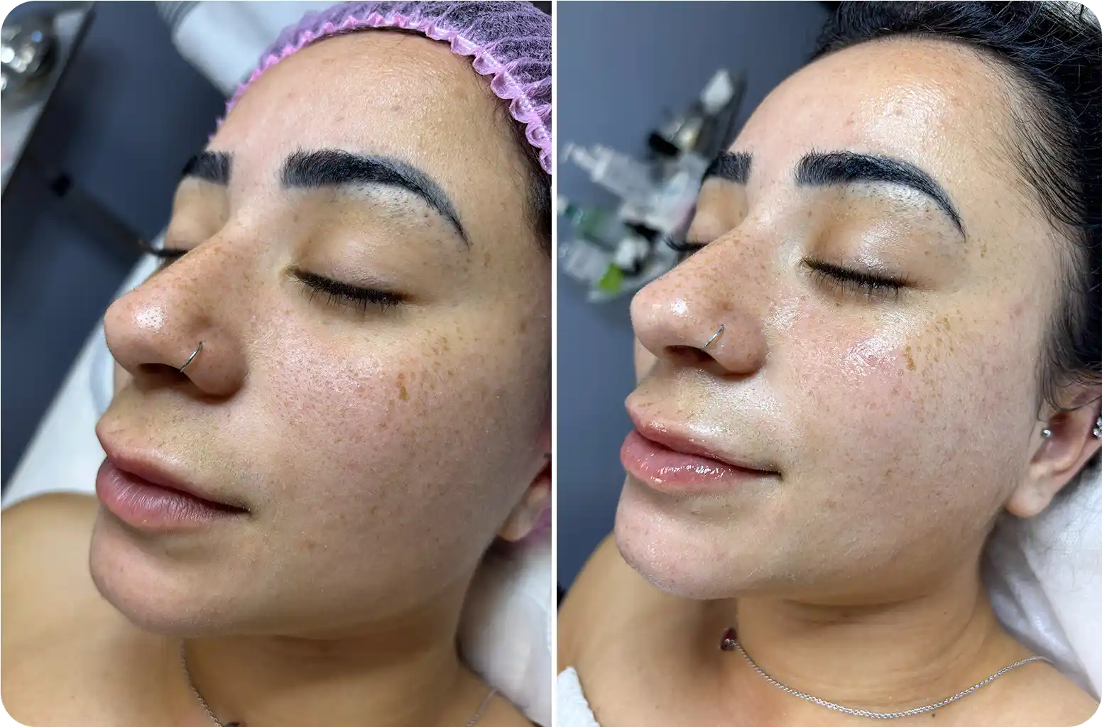Patient Results 3